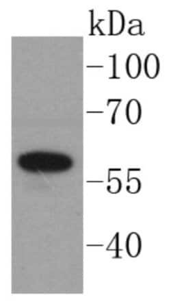 Angiopoietin-1 Antibody (SN67-02), Novus Biologicals 100&mu;L:Antibodies,
