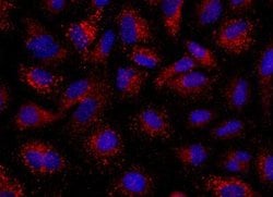 Angiopoietin-2 Rabbit anti-Human, Clone: 117, Novus Biologicals 50 &mu;g;