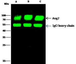 Angiopoietin-2 Rabbit anti-Human, Clone: 117, Novus Biologicals 50 &mu;g;