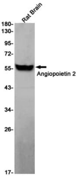 Angiopoietin-2 Antibody (S04-7E6), Novus Biologicals:Antibodies:Primary