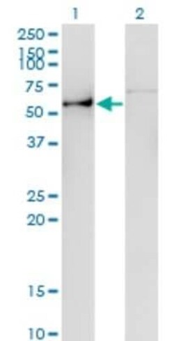 Angiopoietin-like Protein 3/ANGPTL3 Antibody (3B7), Novus Biologicals 0.1 mg | Buy Online | Novus Biologicals | Fisher Scientific