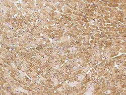 Angiopoietin-like Protein 4/ANGPTL4 Antibody, Novus Biologicals 50 &mu;g | Buy Online | Novus Biologicals | Fisher Scientific