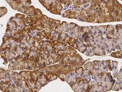 Angiopoietin-like Protein 4/ANGPTL4 Antibody, Novus Biologicals 50 &mu;g | Buy Online | Novus Biologicals | Fisher Scientific