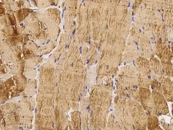 Angiopoietin-like Protein 4/ANGPTL4 Antibody, Novus Biologicals 50 &mu;g | Buy Online | Novus Biologicals | Fisher Scientific