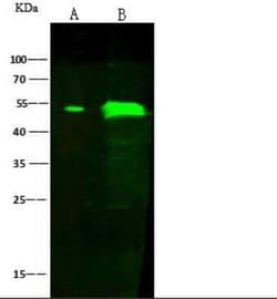 Angiopoietin-like Protein 4/ANGPTL4 Antibody, Novus Biologicals 50 &mu;g | Buy Online | Novus Biologicals | Fisher Scientific