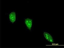 Angiopoietin-like Protein 7/ANGPTL7 Antibody (2C6), Novus Biologicals 100 &mu;g | Buy Online | Novus Biologicals | Fisher Scientific
