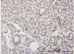 Angiopoietin-like Protein 7/ANGPTL7 Antibody (3E7), Novus Biologicals 100