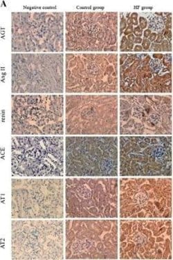Angiotensin II/III Antibody (Ang II E7 (BGN/KA/4L)) - BSA Free, Novus Biologicals:Antibodies:Primary