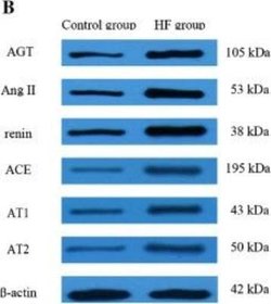 Angiotensin II/III Antibody (Ang II E7 (BGN/KA/4L)) - BSA Free, Novus Biologicals:Antibodies:Primary