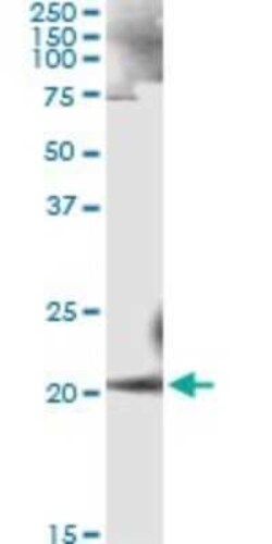 Ankyrin 1 Antibody (3C3), Novus Biologicals 0.1 mg | Buy Online | Novus Biologicals | Fisher Scientific