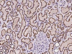 Ankyrin Repeat Domain 33B Antibody, Novus Biologicals:Antibodies:Primary
