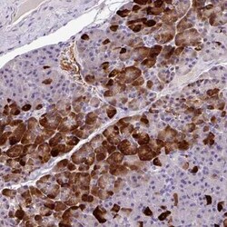 Annexin 2 Receptor Antibody, Novus Biologicals 0.1 mL, Unconjugated:Antibodies,