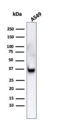 Annexin A1 Antibody (ANXA1/3566) - Azide and BSA Free, Novus Biologicals