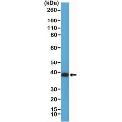 Annexin A1 Rabbit anti-Human, Clone: RM424, Novus Biologicals:Antibodies:Primary