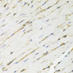Annexin A2 Antibody - BSA Free, Novus Biologicals:Antibodies:Primary Antibodies