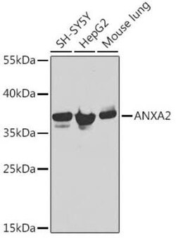 Annexin A2 Antibody - BSA Free, Novus Biologicals:Antibodies:Primary Antibodies