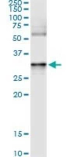Annexin A3 Antibody (1E2), Novus Biologicals 0.1 mg | Buy Online | Novus Biologicals | Fisher Scientific