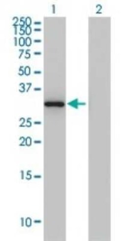 Annexin A3 Antibody (4F1), Novus Biologicals 0.1 mg | Buy Online | Novus Biologicals | Fisher Scientific