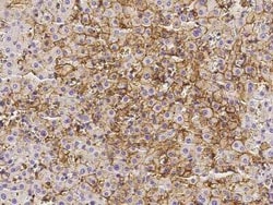 Annexin A6 Antibody, Novus Biologicals 100 &mu;g, Unconjugated:Antibodies,