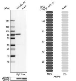 Annexin A6 Antibody, Novus Biologicals 25 &mu;L; Unconjugated:Antibodies,