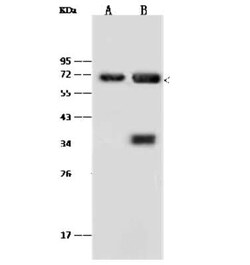 Annexin A6 Antibody, Novus Biologicals 100 &mu;g; Unconjugated:Antibodies,