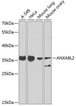 Annexin A8/ANXA8 Antibody - BSA Free, Novus Biologicals:Antibodies:Primary