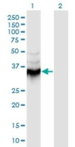 Annexin A9 Antibody (5G3), Novus Biologicals 0.1 mg | Buy Online | Novus Biologicals | Fisher Scientific
