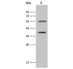 Annexin A9 Antibody, Novus Biologicals 50 &mu;g; Unconjugated:Antibodies,
