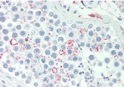 ADIG Antibody, Novus Biologicals 0.1 mg; Unconjugated:Antibodies, Polyclonal