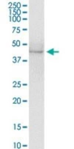 Antizyme inhibitor 1 Antibody, Novus Biologicals 0.1 mg | Buy Online | Novus Biologicals | Fisher Scientific