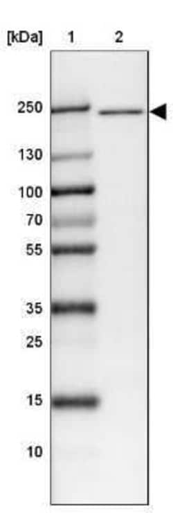 Apc1 Antibody, Novus Biologicals 0.1 mL; Unconjugated:Antibodies, Polyclonal