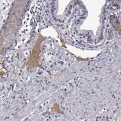 Apolipoprotein A-II/ApoA2 Rabbit anti-Human, Polyclonal, Novus Biologicals:Antibodies:Primary