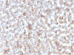 Apolipoprotein B/ApoB Mouse anti-Human, Clone: APOB/3300, Novus Biologicals