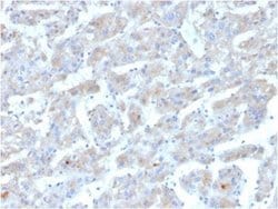 Apolipoprotein B/ApoB Mouse anti-Human, Clone: APOB/3300, Novus Biologicals