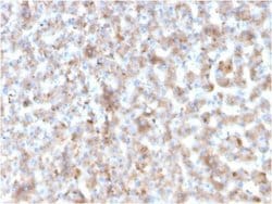 Apolipoprotein B/ApoB Antibody (APOB/3300) - Azide and BSA Free, Novus Biologicals 100 &mu;g | Buy Online | Novus Biologicals | Fisher Scientific