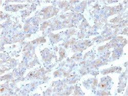 Apolipoprotein B/ApoB Antibody (APOB/3300) - Azide and BSA Free, Novus Biologicals 100 &mu;g | Buy Online | Novus Biologicals | Fisher Scientific