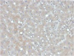 Apolipoprotein B/ApoB Mouse anti-Human, Clone: APOB/4333, Novus Biologicals:Antibodies:Primary