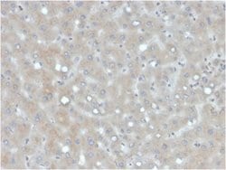 Apolipoprotein B/ApoB Antibody (APOB/4333) - Azide and BSA Free, Novus