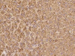 Apolipoprotein C-II/ApoC2 Antibody, Novus Biologicals 100 &mu;g | Buy Online | Novus Biologicals | Fisher Scientific