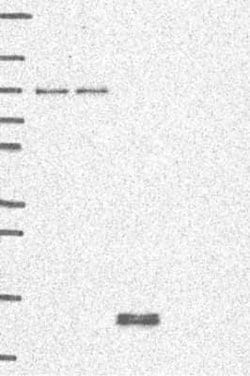 Apolipoprotein CIII Rabbit anti-Human, Polyclonal, Novus Biologicals:Antibodies:Primary