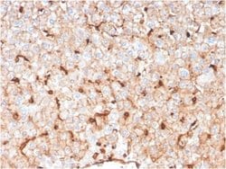 Apolipoprotein D Mouse anti-Human, Clone: APOD/3414, Novus Biologicals:Antibodies:Primary