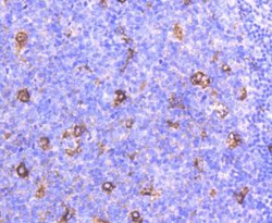 Apolipoprotein E/ApoE Rabbit anti-Human, Clone: SC0536, Novus Biologicals 100 &mu;L | Buy Online | Novus Biologicals | Fisher Scientific