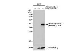 Apolipoprotein E/ApoE Antibody - R136S Mutant, Novus Biologicals 100 &mu;g;