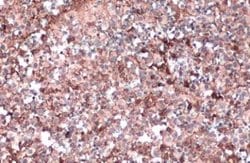 Apolipoprotein E/ApoE Antibody - BSA Free, Novus Biologicals 0.025 mg;