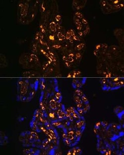 Apolipoprotein E R2/ApoE R2 Antibody - BSA Free, Novus Biologicals:Antibodies:Primary