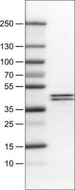 Apolipoprotein L1 Antibody (CL0173), Novus Biologicals 25 &mu;L, Unconjugated:Antibodies,
