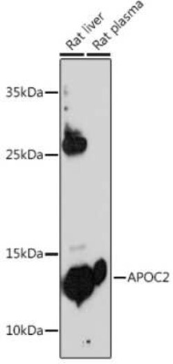 Apolipoprotein C-II/ApoC2 Antibody - BSA Free, Novus Biologicals 0.02 mL,
