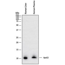 Human Apolipoprotein C-II/ApoC2 Antibody, R D Systems 25 &mu;g | Buy Online | R&D Systems | Fisher Scientific