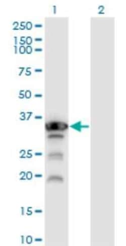 Aprataxin Antibody (2H6), Novus Biologicals 0.1 mg, Unconjugated:Antibodies,