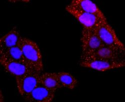 Aquaporin 1/AQP1 Antibody (JM10-98), Novus Biologicals 100&mu;L:Antibodies,